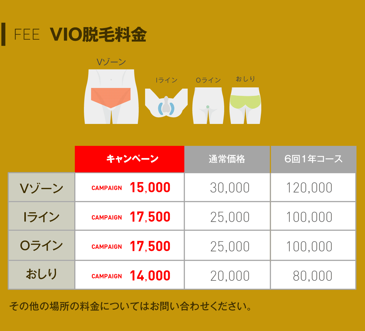 VIO脱毛料金 